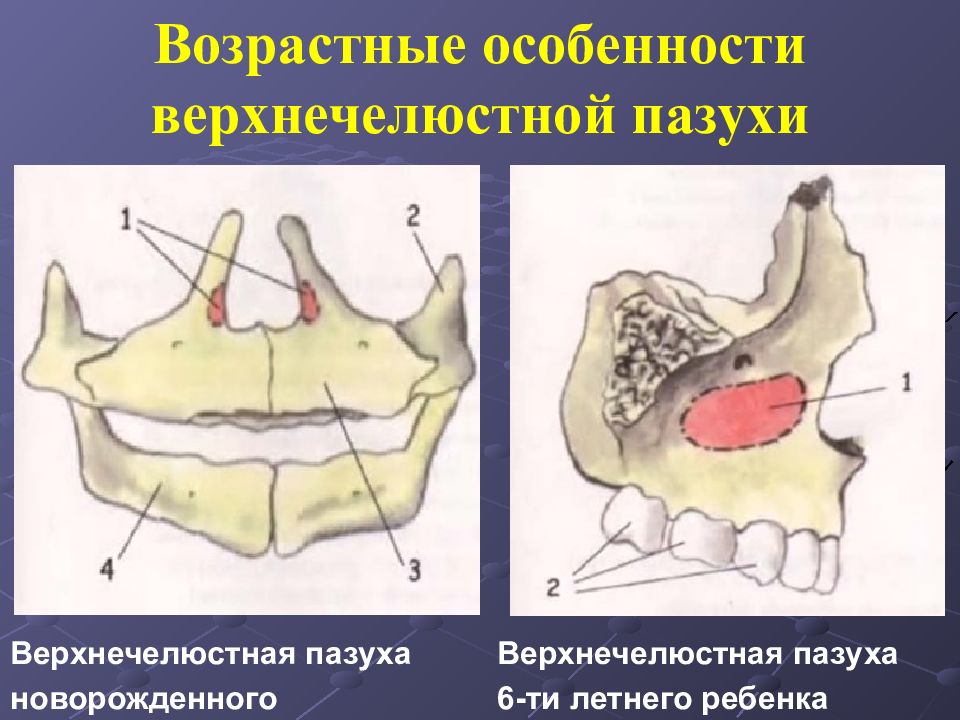 Пазуха верхнечелюстной кости