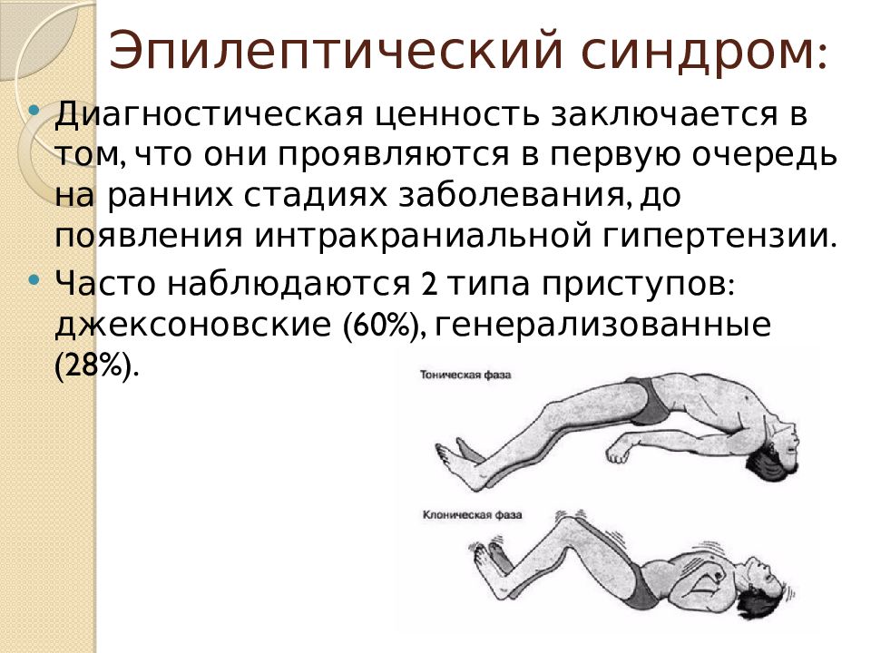 Эпиприступ. Эпилептический синдром. Тонико-клонические судороги у детей. Тоническая фаза эпилептического припадка.