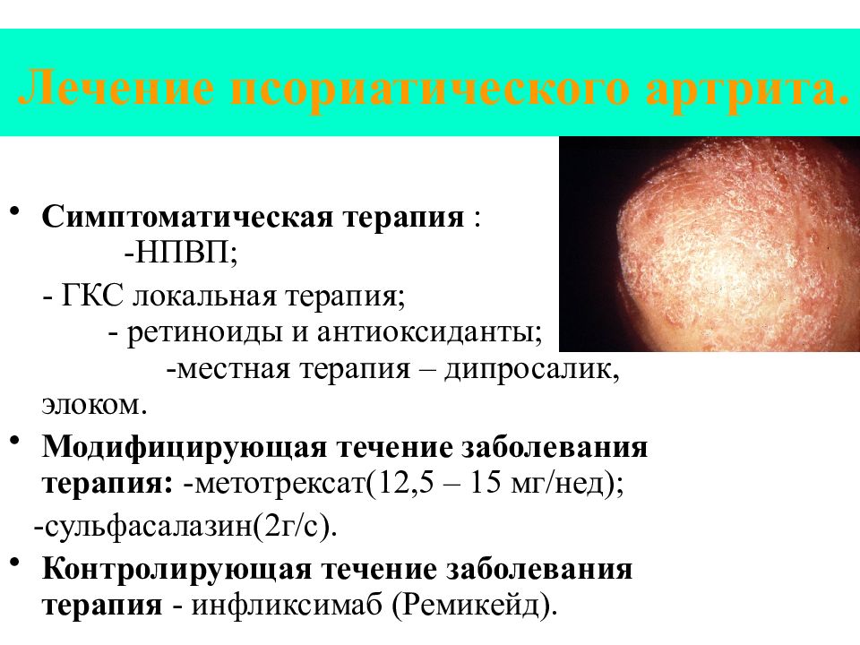 Псориатический артрит презентация