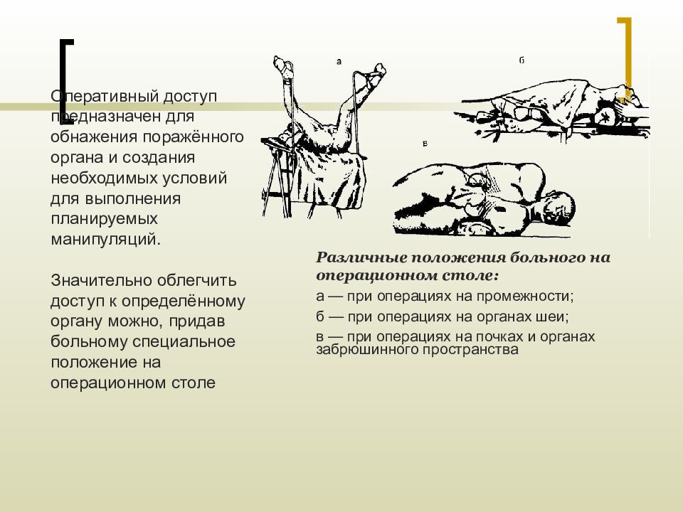 Виды положения пациента на операционном столе