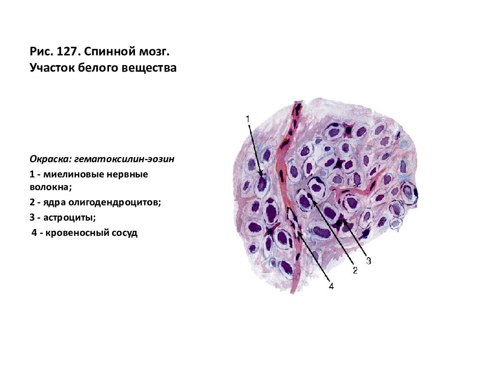 Спинальный ганглий гистология рисунок