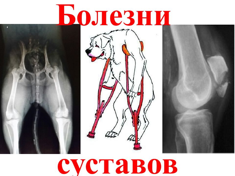 Болезни суставов
