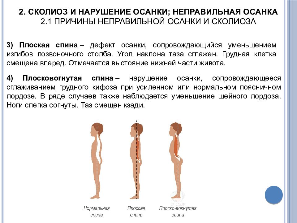 Основная причина нарушения осанки. Осанка и искривление позвоночника. Причины неправильной осанки и сколиоза.. Нарушение опорно-двигательного аппарата нарушение осанки. Нарушение осанки причины и профилактика.