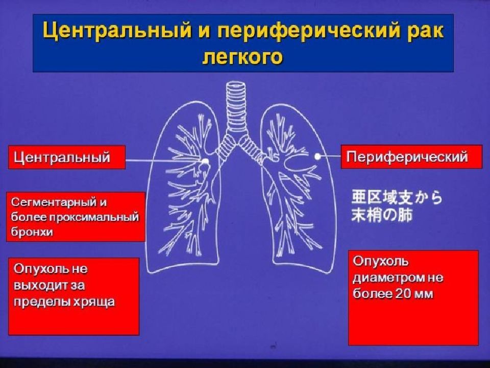 Признаки центрального рака легкого. Периферическая опухоль легкого. Уентральный и периферический ОАК легкого. Центральная опухоль легкого.