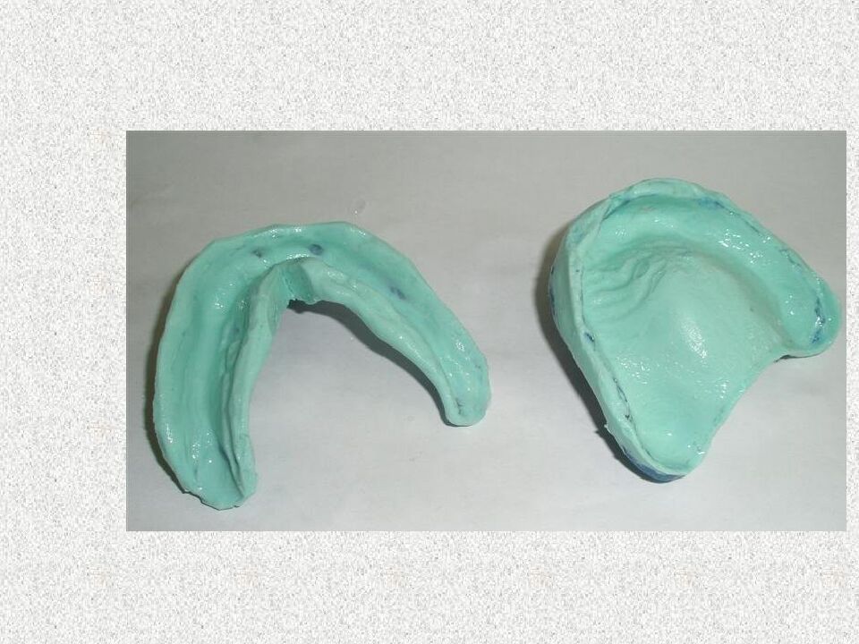 Funksional otisklar uchun individual qoshiqchalar