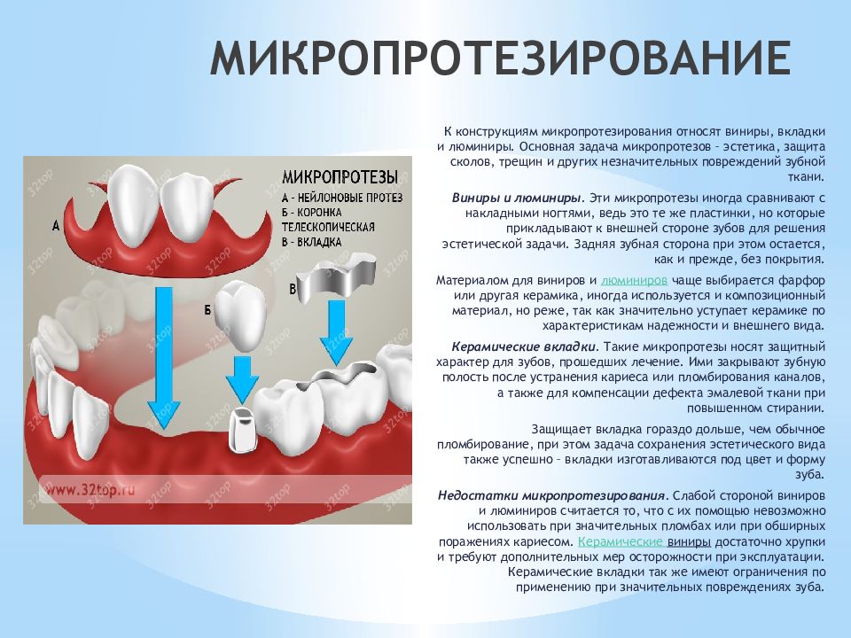 Керамические виниры презентация