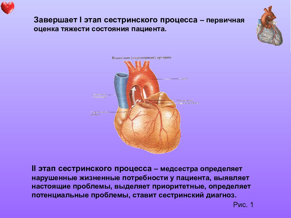 2 стадия болезни сердца. Стенокардия сестринский процесс. Потенциальные проблемы при ишемической болезни сердца. Стенокардия потенциальные проблемы. ИБС проблемы настоящие и потенциальные.