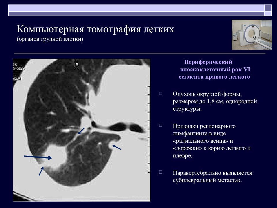 Презентация кт легких