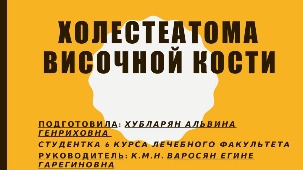 Холестеатома височной кости