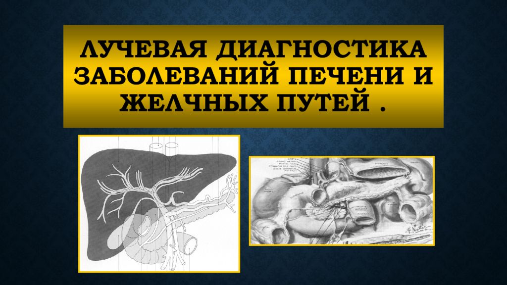 Диагностика печени. Методы лучевого исследования печени и желчевыводящих путей. Лучевая диагностика заболеваний печени. Лучевая диагностика печени и желчевыводящих путей. Методы лучевой диагностики печени.