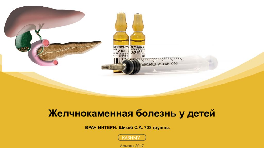 Алматы 2017 КАЗНМУ ВРАЧ ИНТЕРН: Шикеб С.А. 703 группы. Желчнокаменная болезнь у