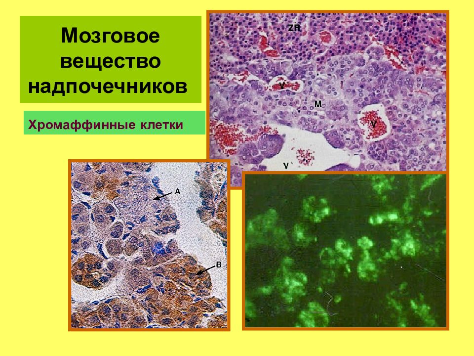 Хромаффинные клетки надпочечников