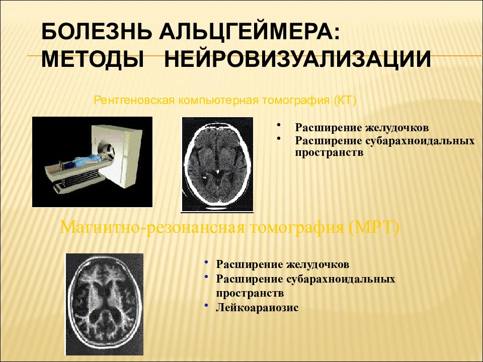 Метод альцгеймера