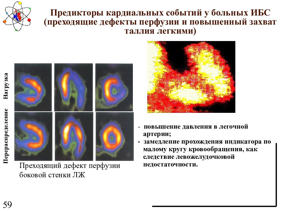 Радионуклидные источники ионизирующего излучения. Радионуклидные методы исследования. Радионуклидные источники. Радионуклидный метод исследования сердца. Кардиальная перфузия.