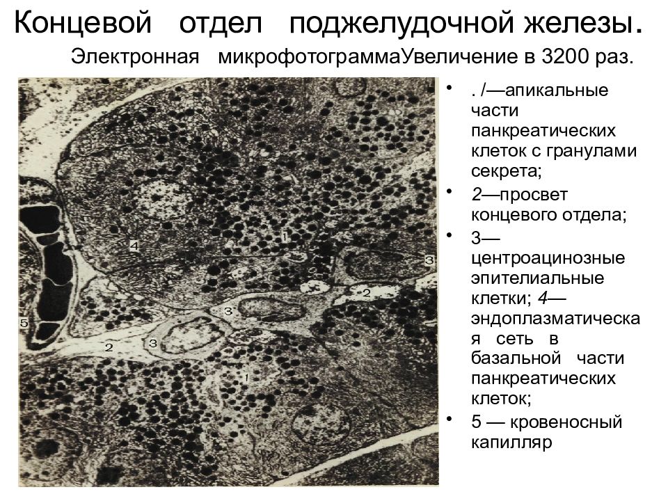 Эпителий печени и поджелудочной железы. Поджелудочная железа Электронограмма. Строение поджелудочной гистология. Электронная микрофотография панкреатита гистология. Ацинус поджелудочной железы микрофотография.