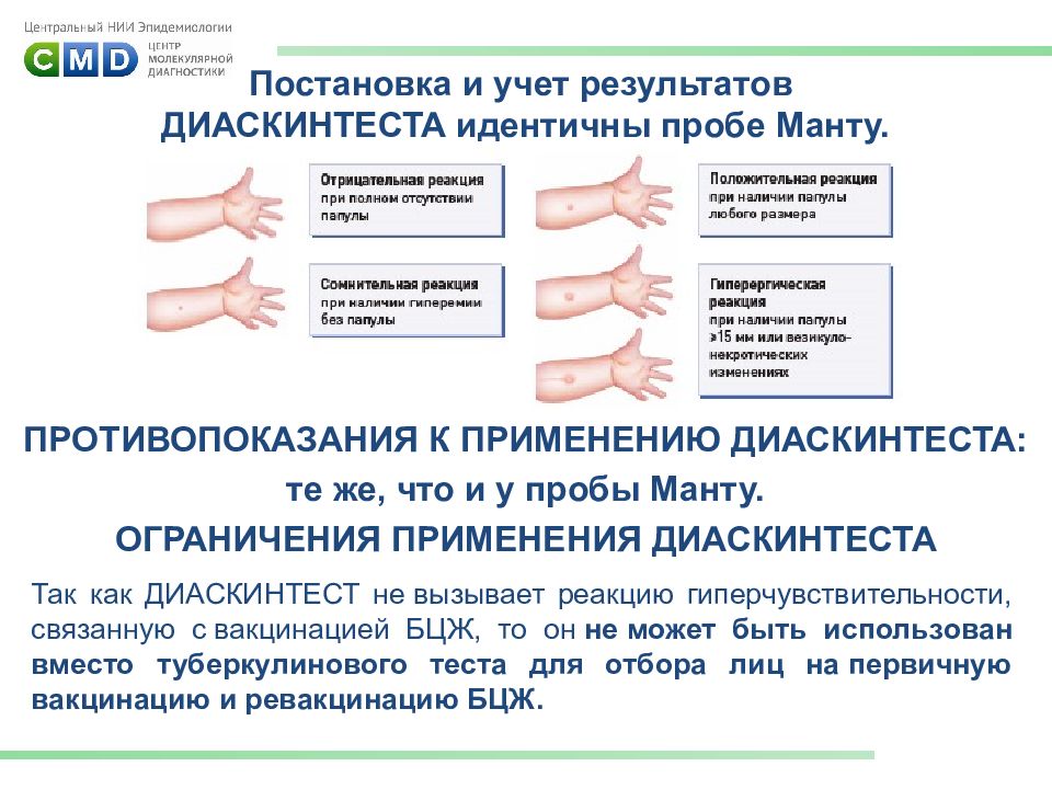 Диаскинтест что это такое. Методика постановки пробы диаскинтест. Диаскинтест оценка реакции. Диаскинтест постановка прививки. Постановка пробы на туберкулез диаскинтест.