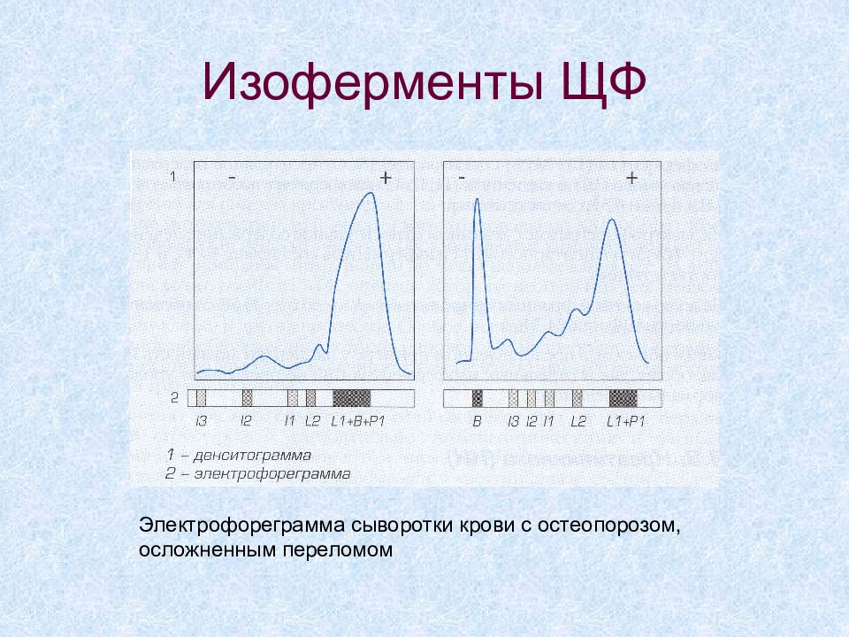 Изоферменты щелочной фосфатазы. Электрофореграмма белков сыворотки крови. Электрофорез белков сыворотки. Электрофорез сыворотки крови. Денситограмма белков сыворотки крови.