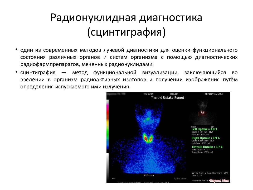 Что такое сцинтиграфия