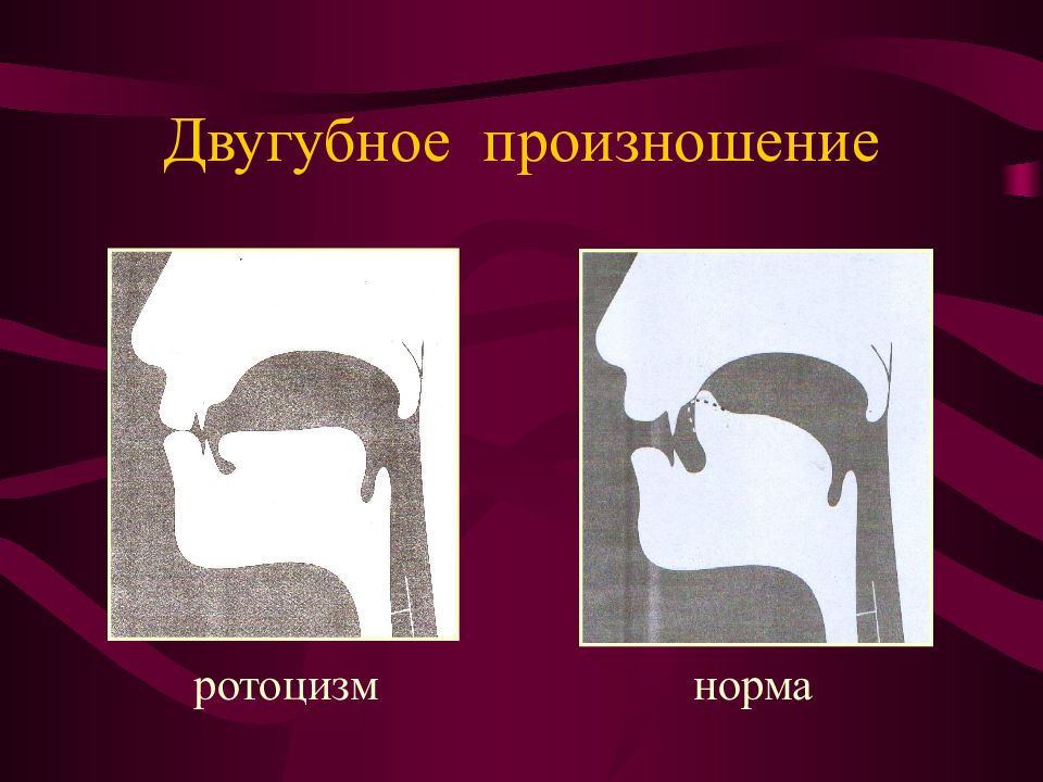 Как говорить р. Правильное произношение буквы р. Нарушение произношения звука р. Как правильно произносить букву р. Как выговаривать р.