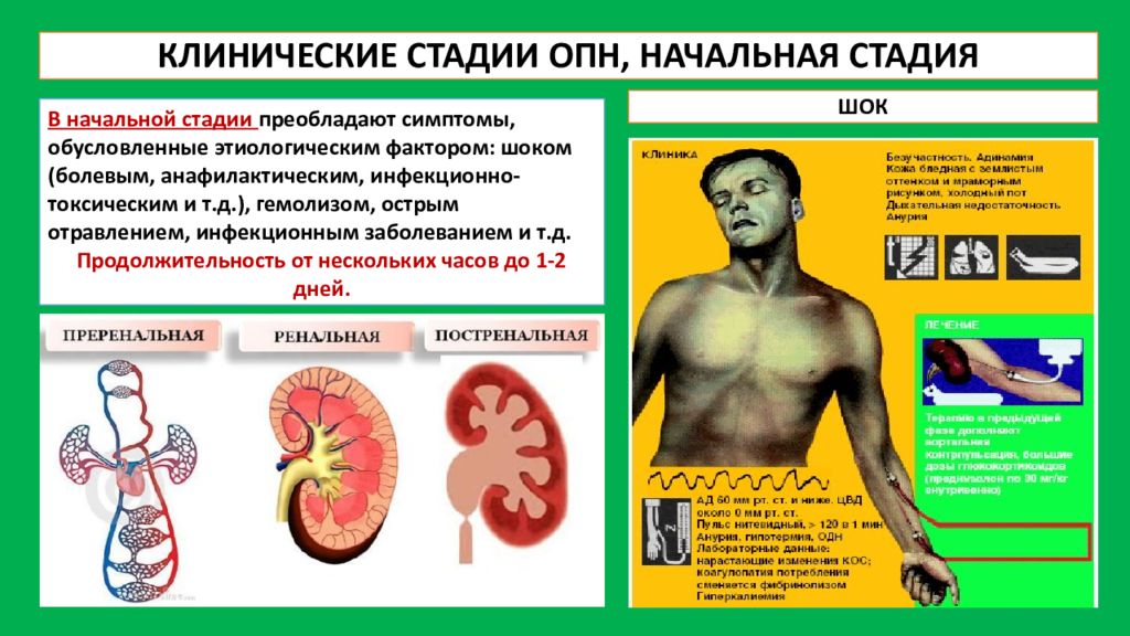 Клиническая картина острой почечной недостаточности