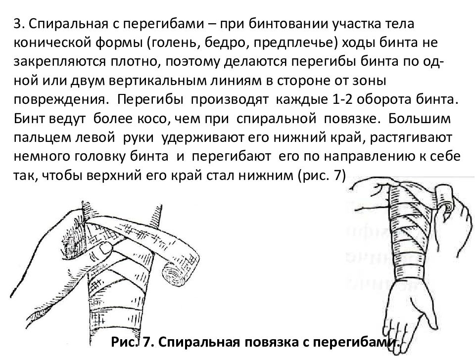 Наложить повязку на предплечье. Спиральная повязка с перегибами на предплечье. Техника наложения спиральной повязки на предплечье. Спиральная повязка с перегибами на голень алгоритм. Методика наложения спиралевидной повязки..