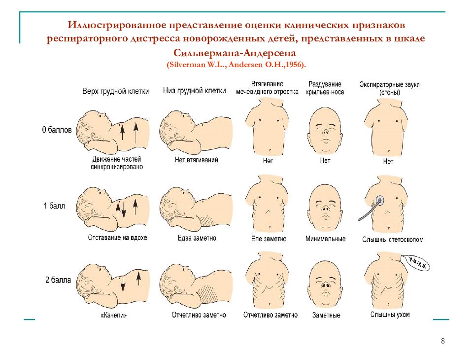 Шкала сильвермана