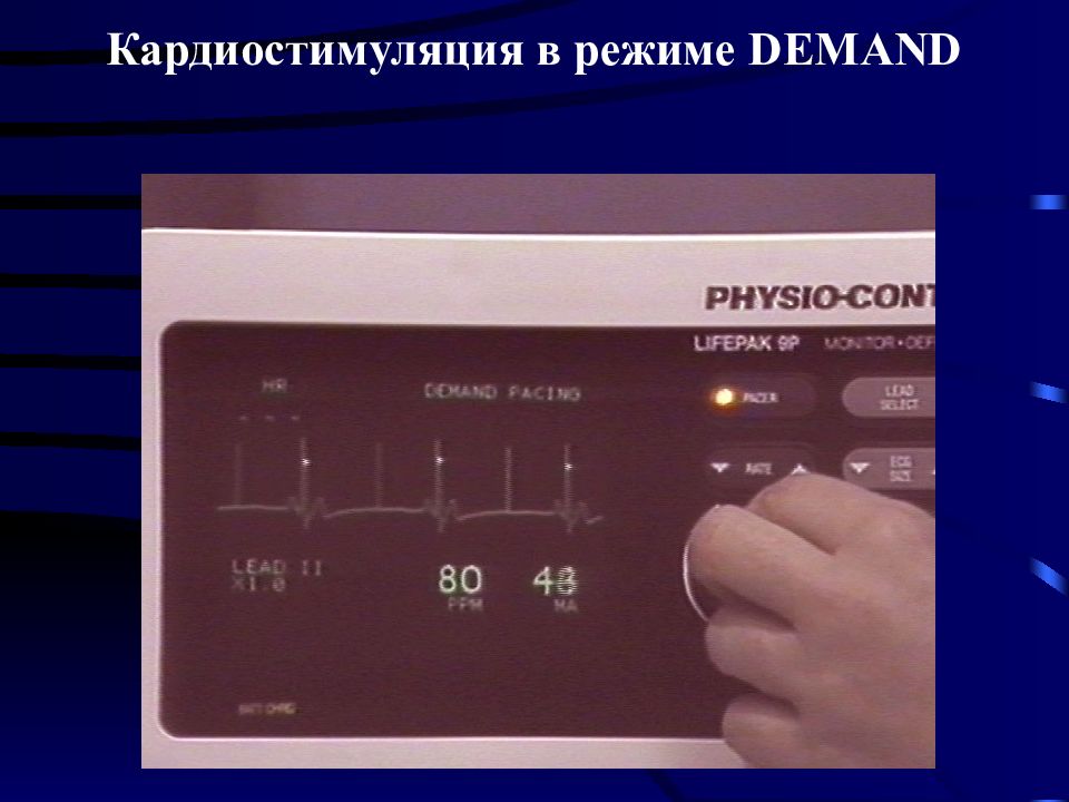 Электроимпульсная терапия презентация