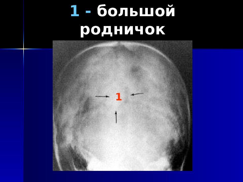 Большой родничок