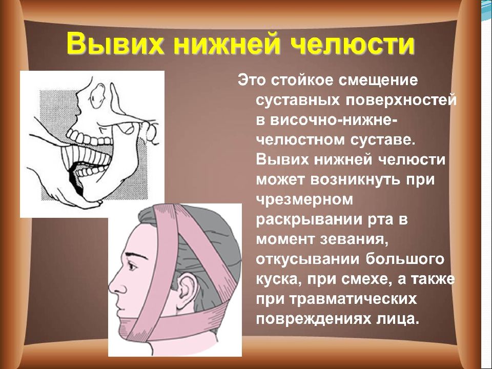 Вывихи и их лечение хирургия презентация