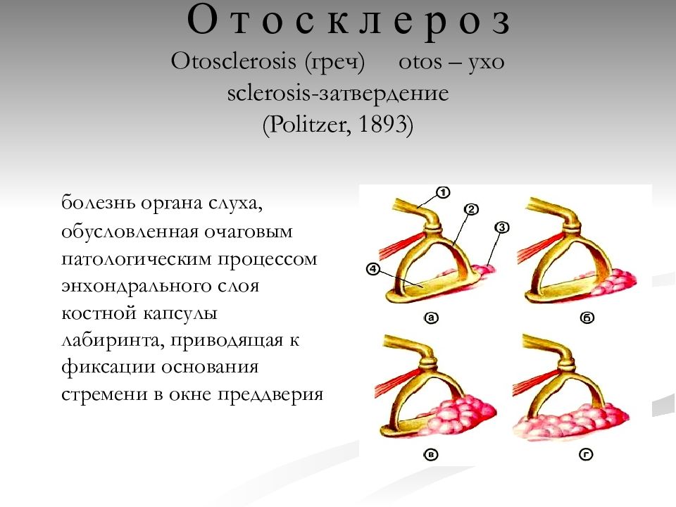 Очагово обусловленные заболевания презентация