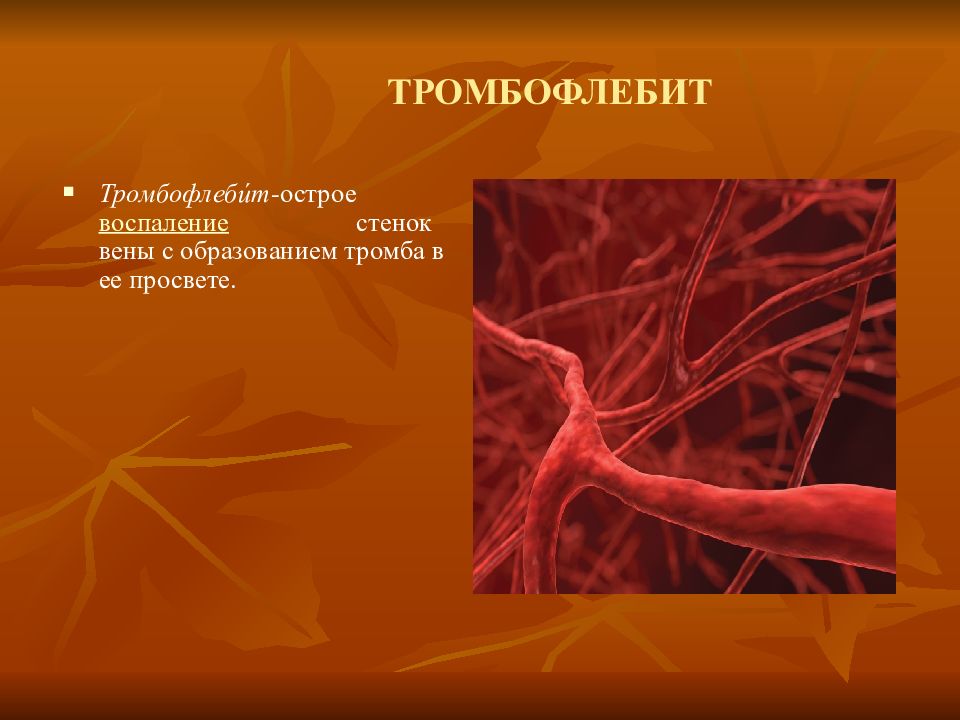 Как проверить есть ли в организме тромбы