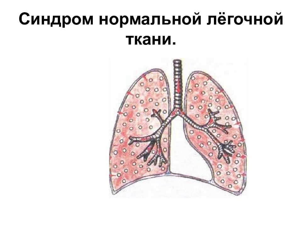 Легочная ткань. Возможности легочной ткани. Нормальная легочная ткань. Эластичный элемент легочной ткани.