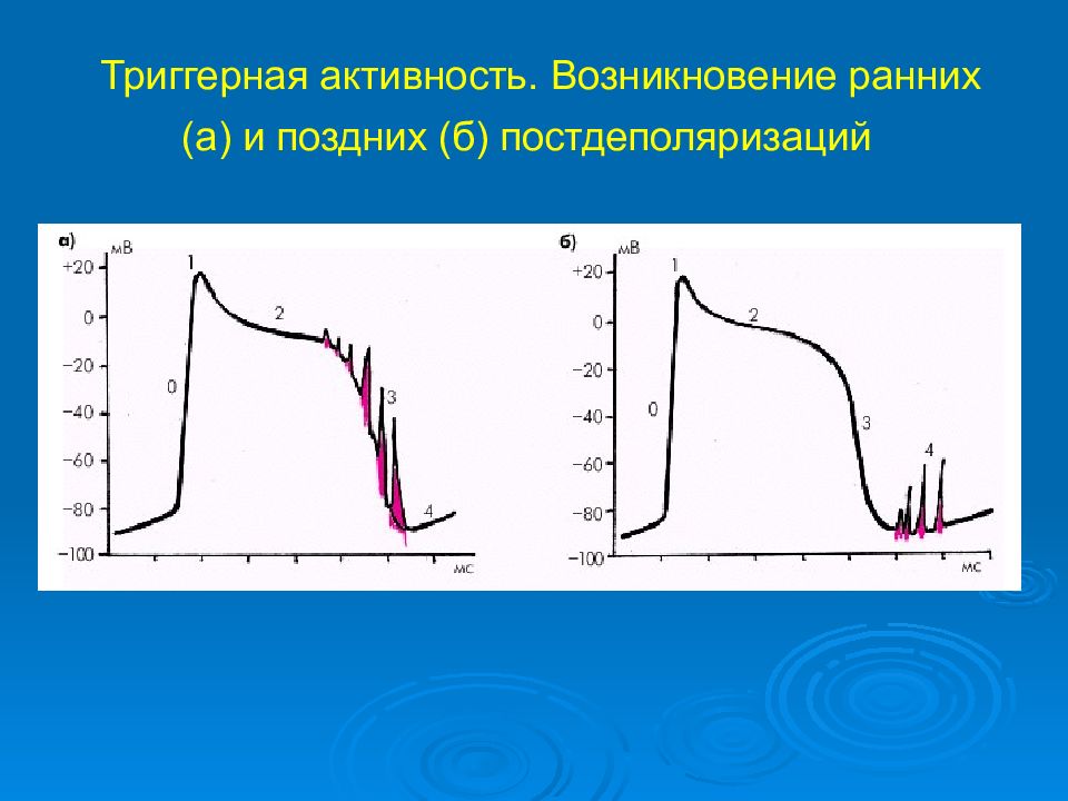 Ранняя активность. Триггернаяактивность ранняяпостдеполяризация. Ранние постдеполяризации. Ранняя постдеполяризация схема. Ранняя и поздняя постдеполяризация.