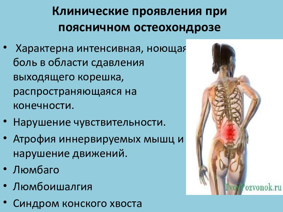 Куда отдает боль при грудном остеохондрозе картинки