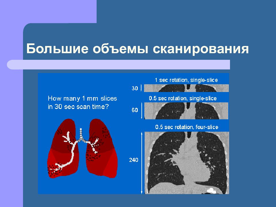 Презентация на тему компьютерная томография