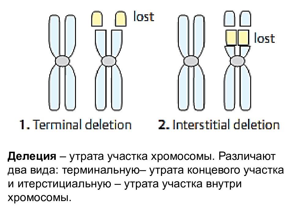 Участки хромосом. Делеция короткого плеча 7 хромосомы. Делеция длинного плеча 7 хромосомы. Потеря концевого участка хромосомы. Концевые делеции это.