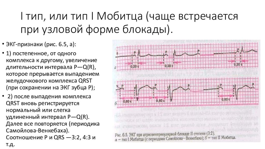 Ав блокада карта вызова