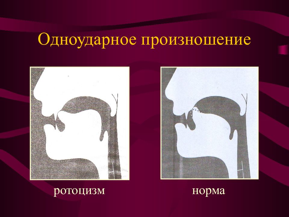 Гнусавость голоса. Горловое произношение буквы р. Увулярное произношение звука р. Схема звука р. Положение языка при произношении звука р.