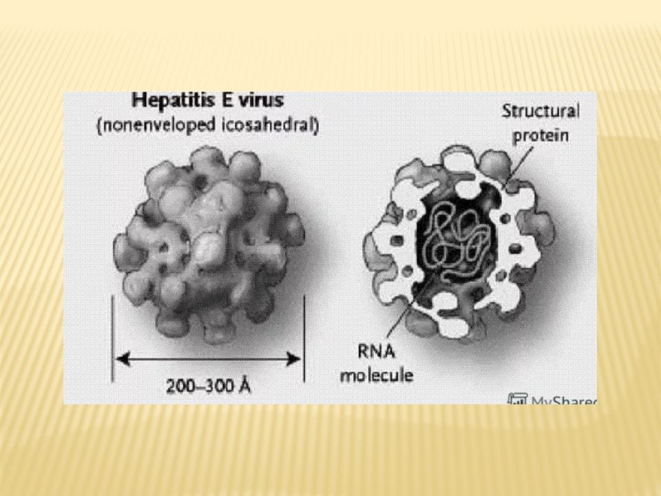 Гепатит е. Гепатит е РНК. Поражаемые структуры гепатита в. Самый опасный вид гепатита. Гепатит разные формы.