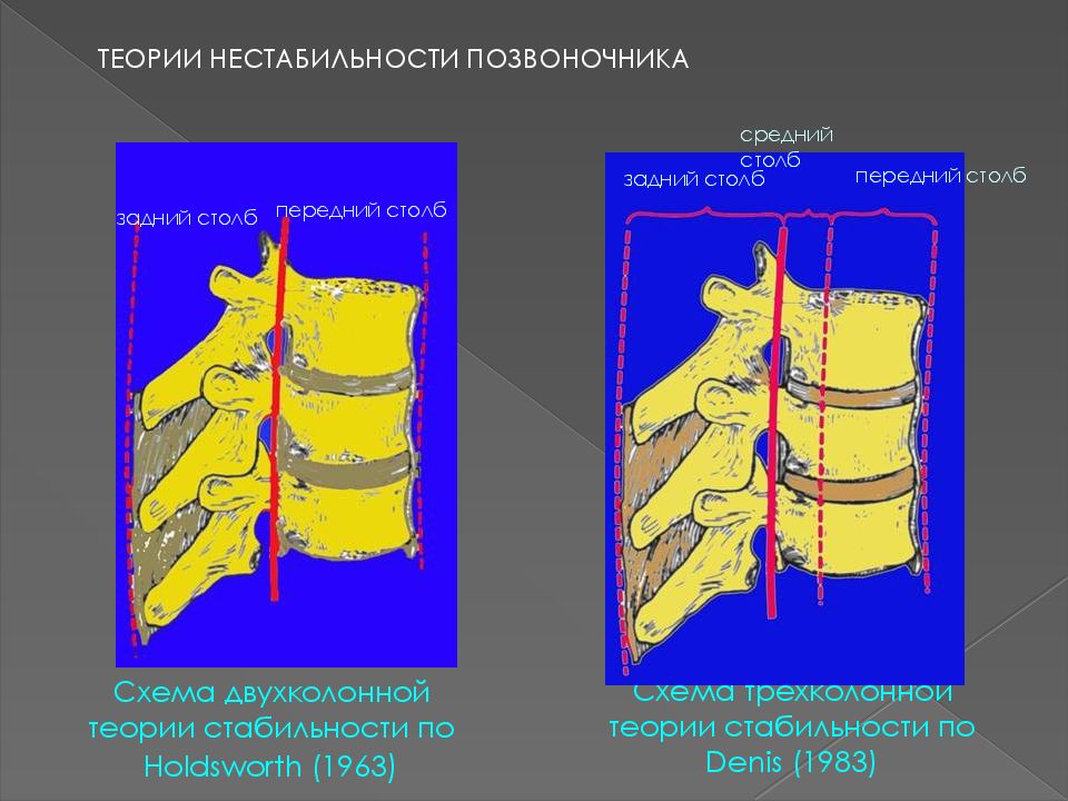 Статистика травм позвоночника. Многоуровневое повреждение позвоночника это. Трехколонная теория позвоночника. Трехколонная концепция стабильности позвоночника. Нестабильность позвоночного столба.