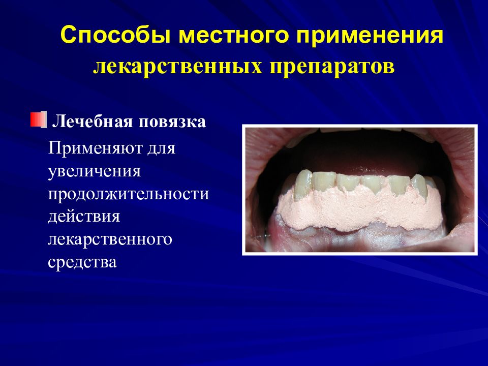 Физиотерапевтические методы лечения заболеваний пародонта презентация