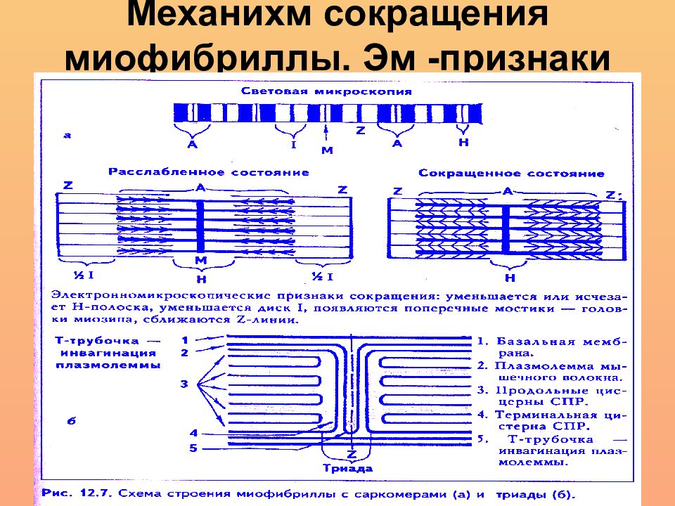 Т система. Структурная организация миофибриллы. Саркомер.. Перечислите электронномикроскопические структуры миофибриллы.. Схема строения миофибриллы. Миофибриллы гистология.