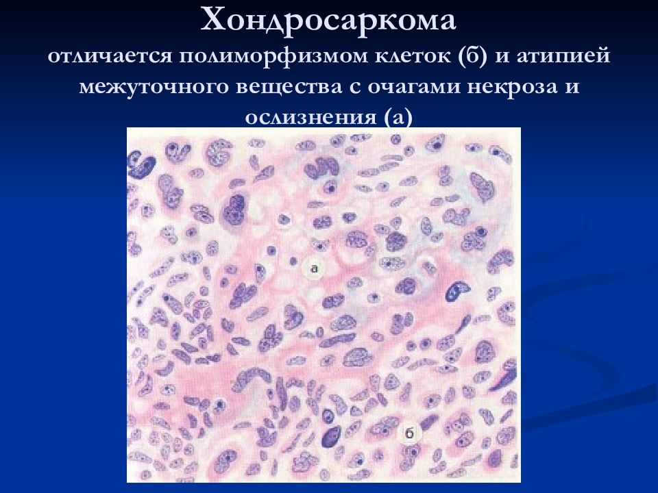 Мезенхимальные опухоли патанатомия презентация