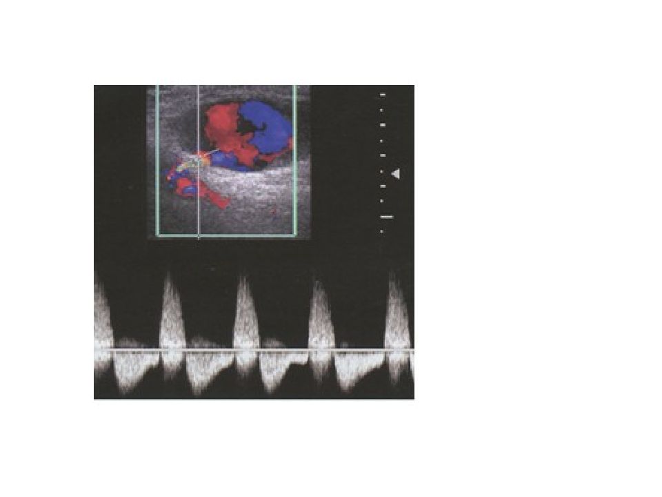 Узи вен нижний тагил. УЗИ сосудов нижних конечностей. УЗИ: спектр кролика. Транс УЗИ сосудов что это.