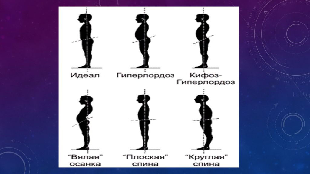 Проект на тему хорошая осанка красота и здоровье на всю жизнь