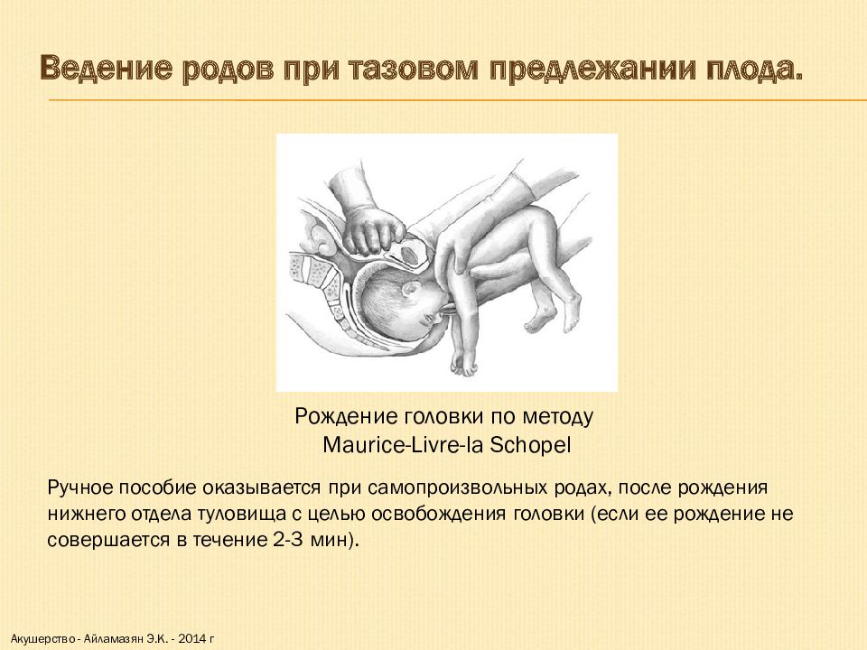 Оказание помощи при тазовых предлежаниях презентация