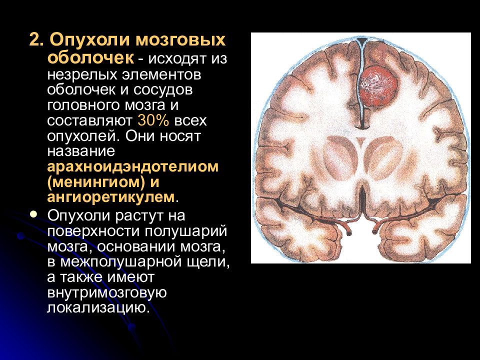 Опухоль мозга презентация