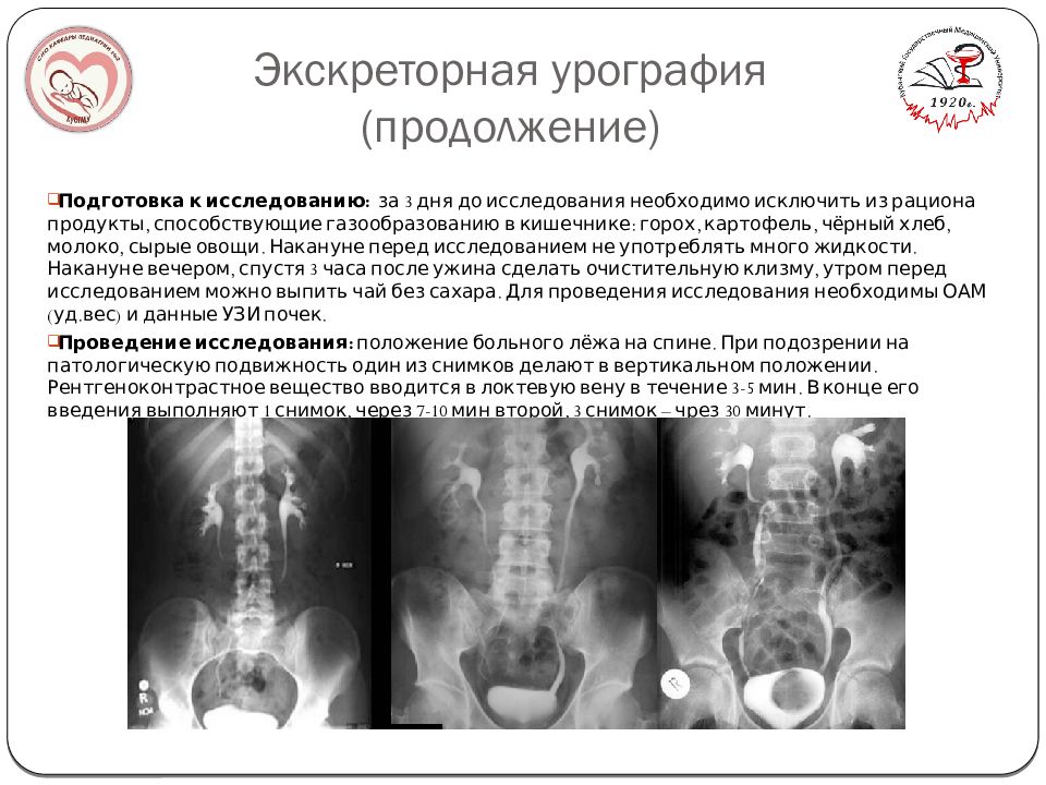 Экскреторная урография презентация