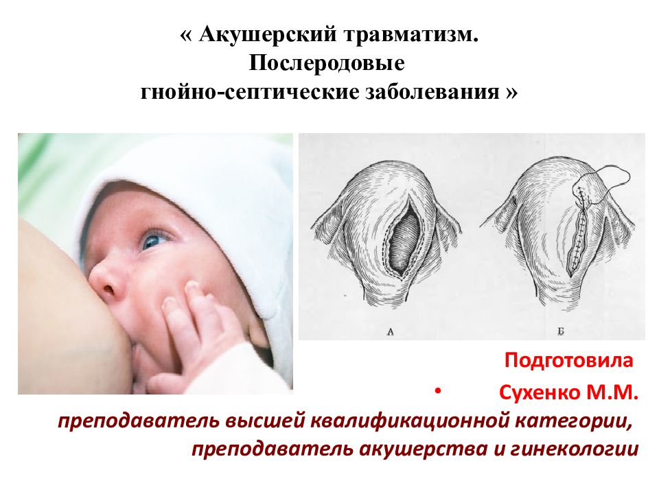 « Акушерский травматизм. Послеродовые гнойно-септические заболевания »