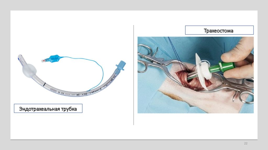 Уход за трахеостомой картинки
